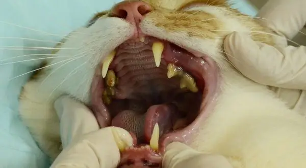 Dental calculus