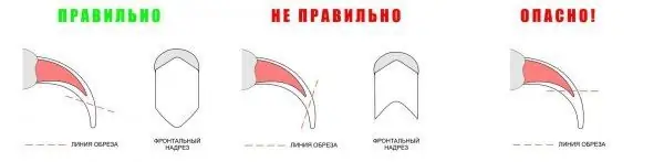 Тырмакты туура кыркуу