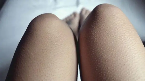 Legs in goose bumps