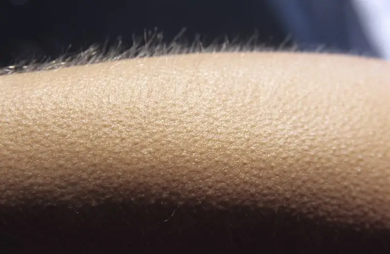 Why Goosebumps Appear, Run Over The Head, Legs And Arms